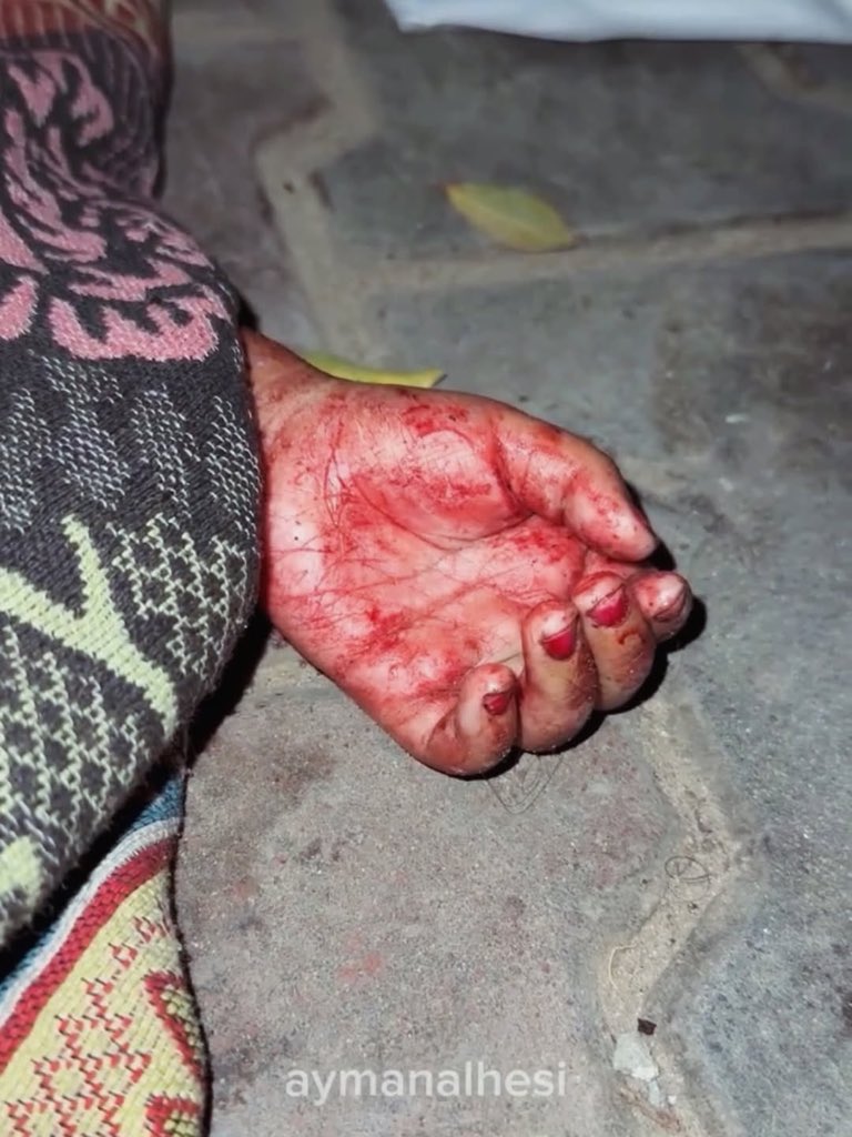 Double Standard in World Leaders’ Response to Gaza Casualties