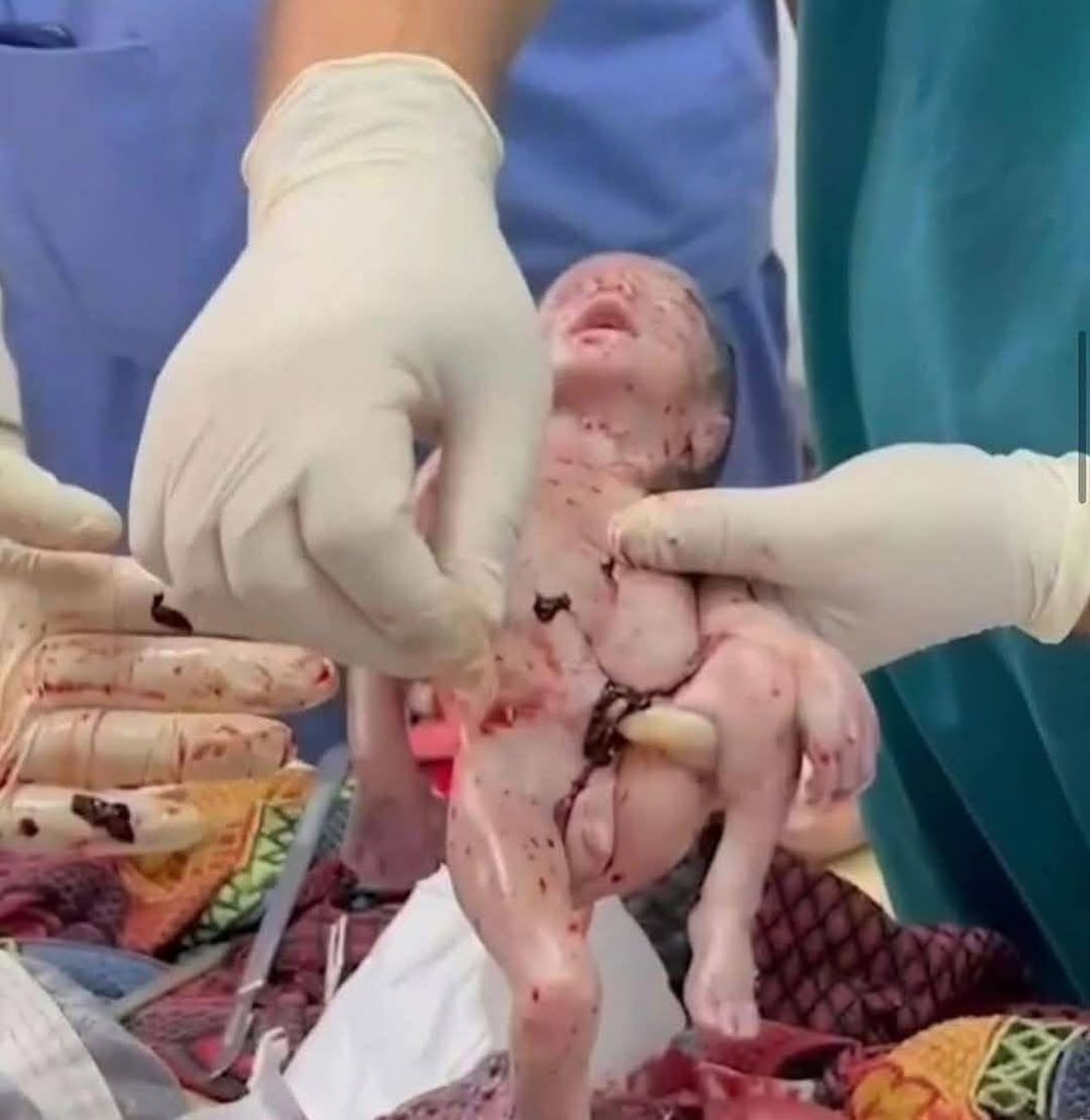 Gaza Strip bombing kills 21 including children