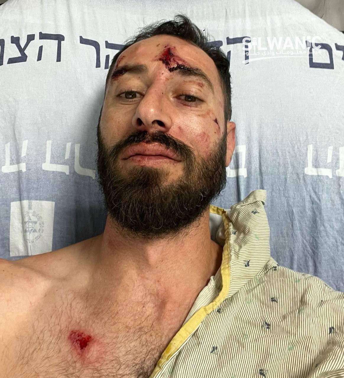 Palestinian Man Beaten by Israeli Troops in Jerusalem