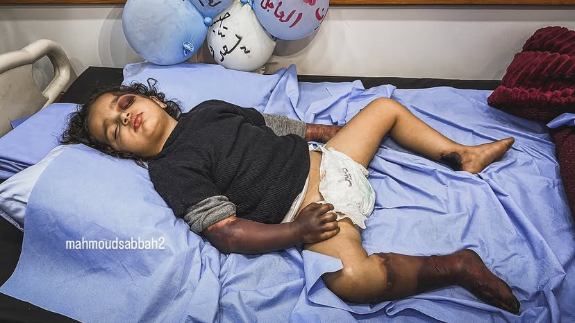Young Girl Habiba Struggles with Rare Protein C Deficiency
