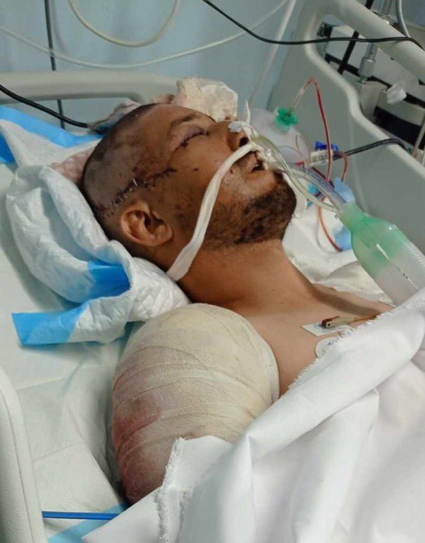 Prayer request for Al Jazeera cameraman Ahmad Matar in critical condition