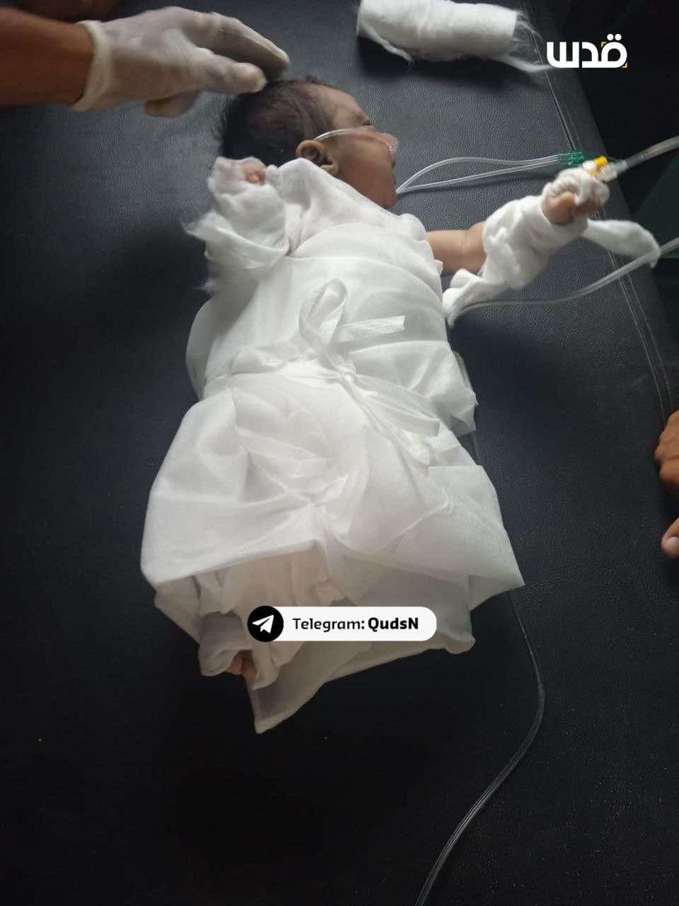 Infant sole survivor after Israeli airstrike kills parents in Gaza