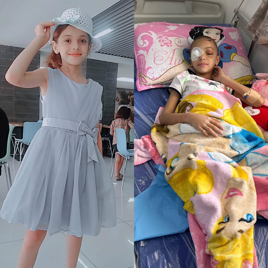 12-year-old girl severely injured in Israeli bombing loses eyesight