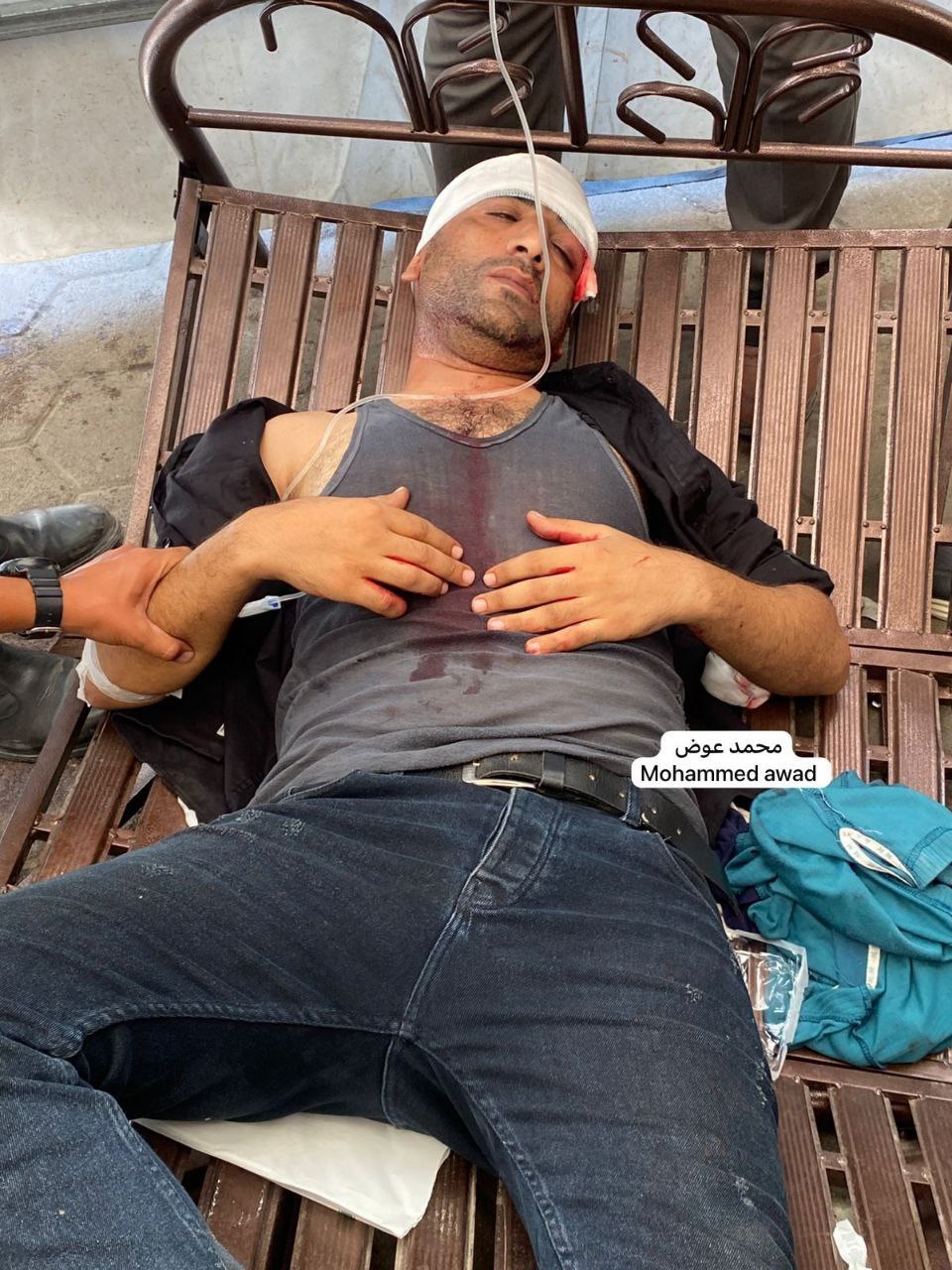 Journalist Akram Daloul injured in Israeli airstrike Gaza