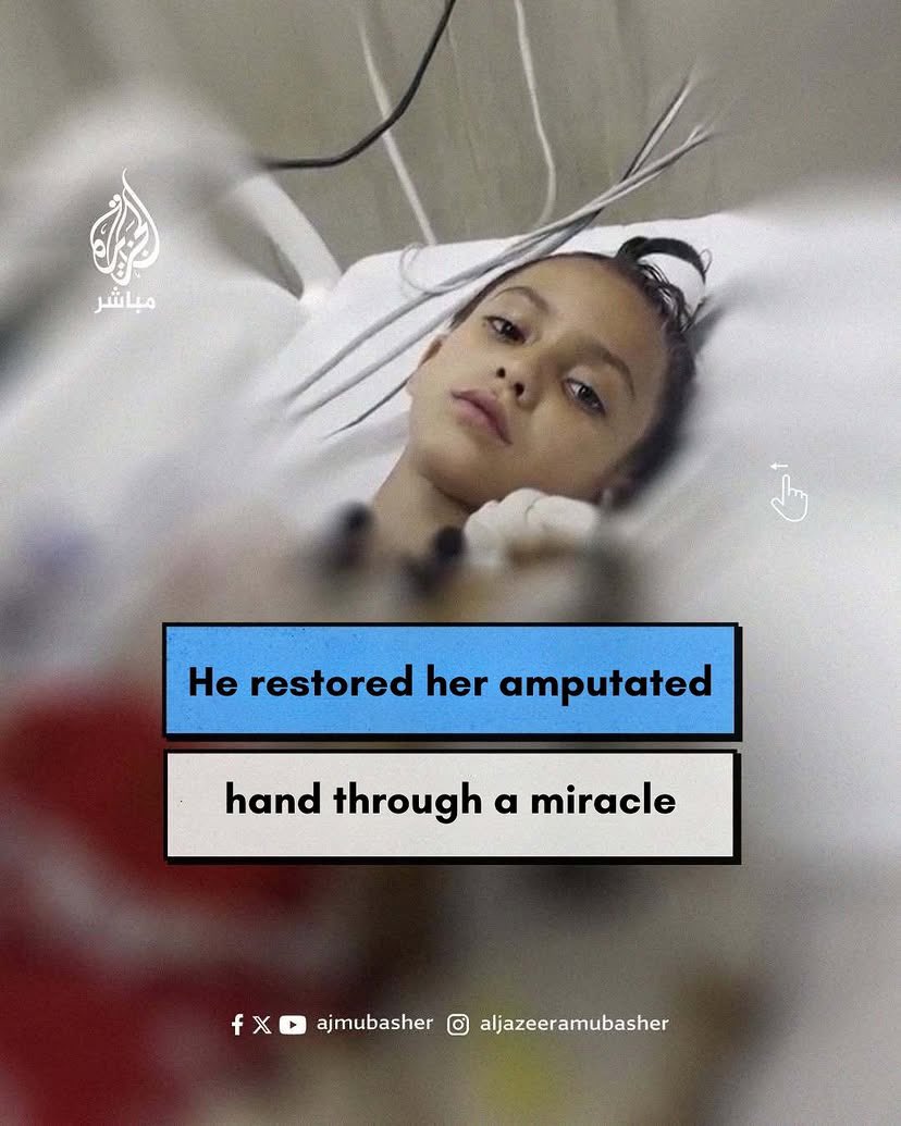 Iraqi Doctor Restores Severed Hand of Gaza Child After Bombardment