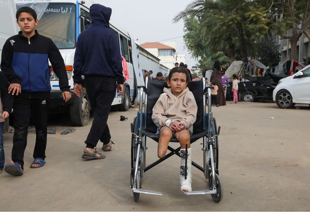 Ten Gaza children lose legs daily to Israeli military operations