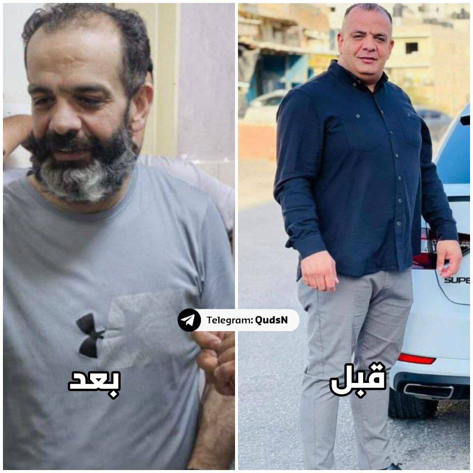 Israeli Authorities Release Tortured Palestinian Prisoner Ahmad Abu Satha