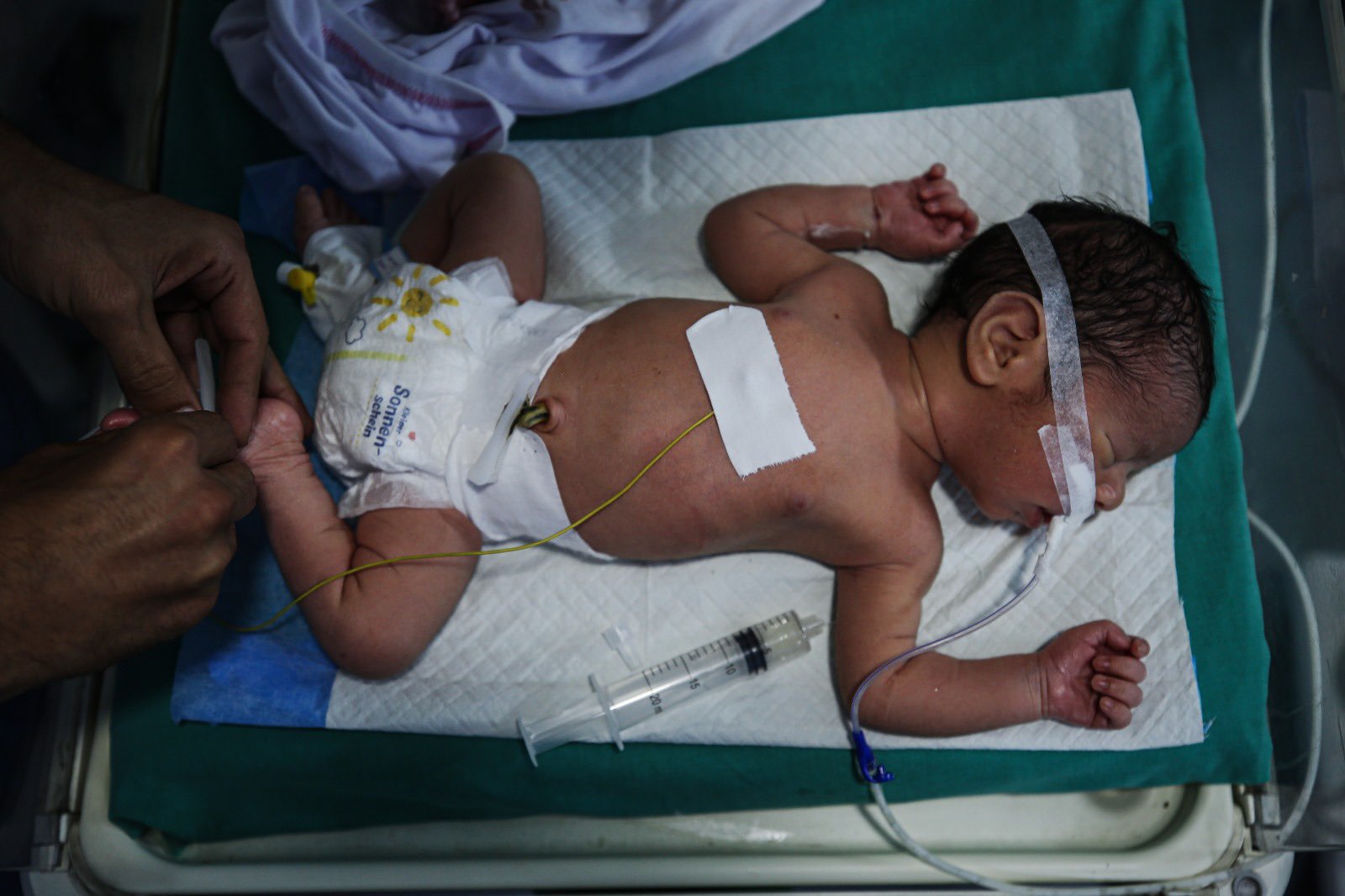 Infant casualty from Israeli military operations in Gaza