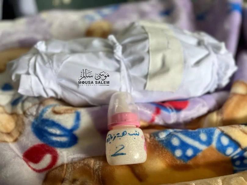 Child Death from Malnutrition in Jabalia, Gaza