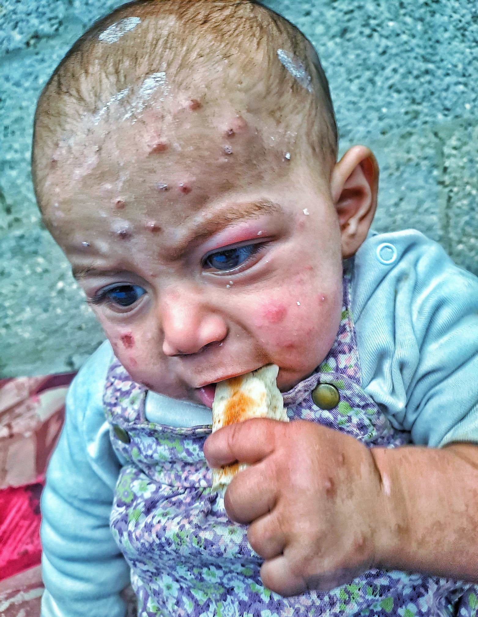 Humanitarian Crisis: Starvation, Lack of Medicine and Bombing