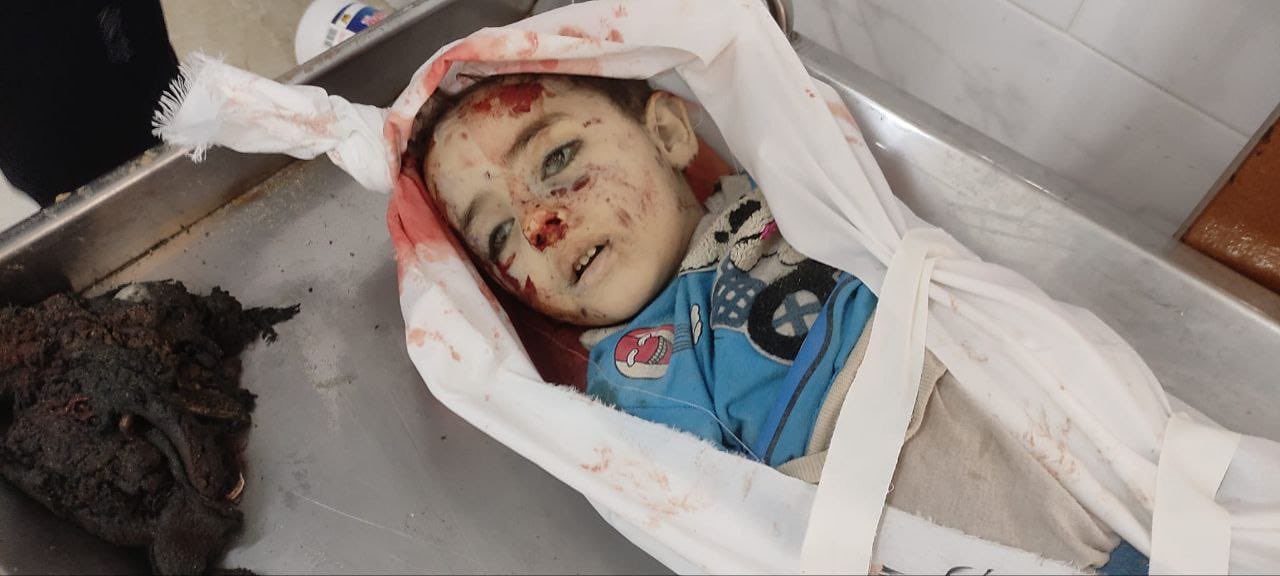Deaths of children in Gaza amid Israeli occupation and Western support