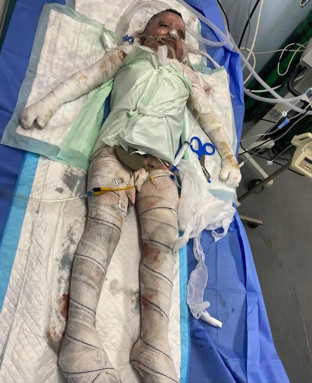 12-Year-Old Omar Al-Hosari Sole Survivor After Family Home Bombed