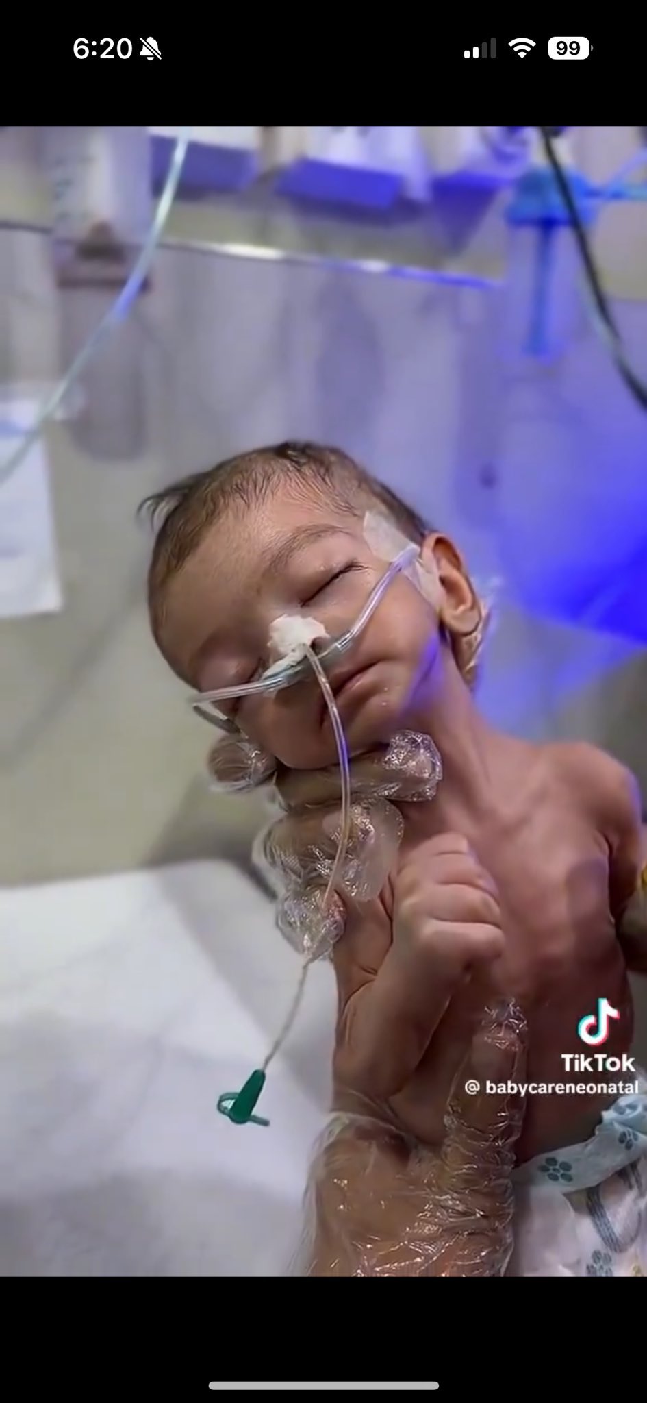 Medical Director Reports Famine Crisis and Malnutrition in Gaza