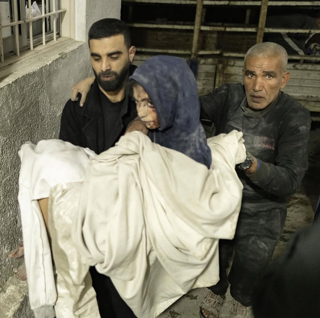 Israeli airstrikes on Gaza Strip causing casualties