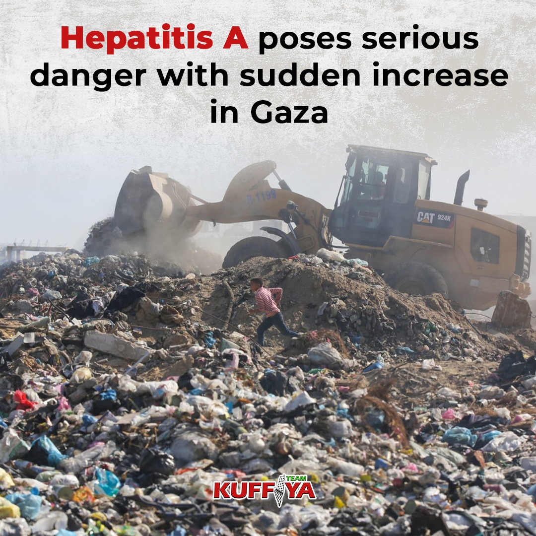 Hepatitis A Outbreak Spreads Among Palestinian Children in Gaza