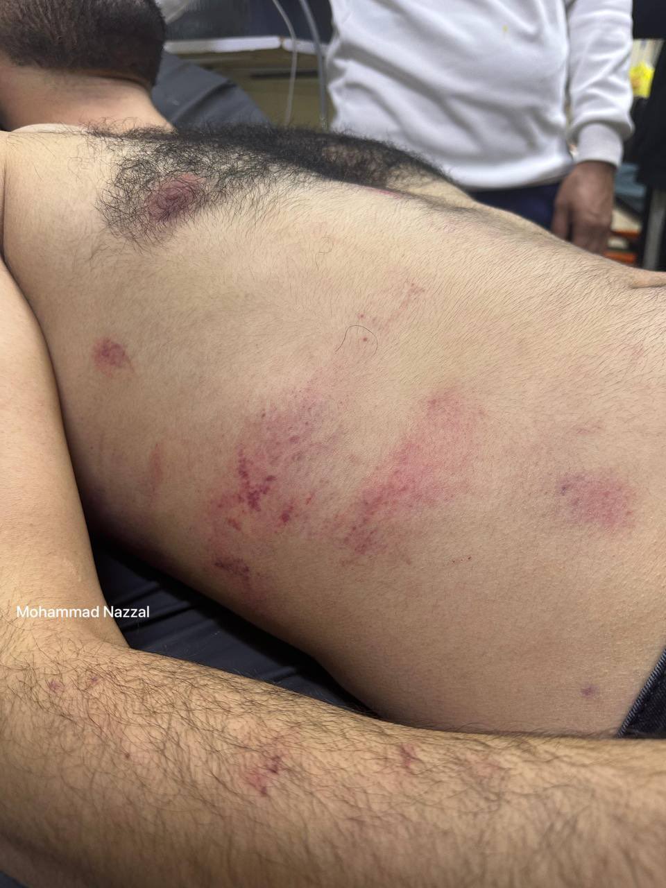 Three Young Men Beaten by Occupation Soldiers Near Jericho