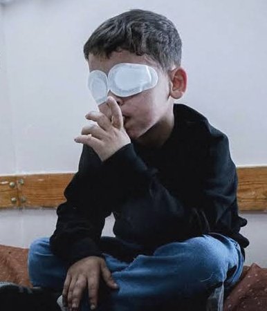1,700 Palestinians Lost Eyesight in 25 Months, 5,000 at Risk