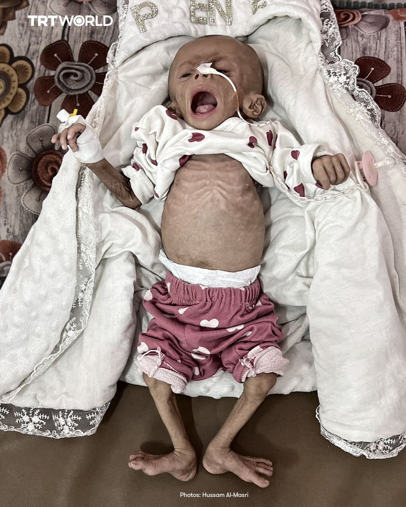 MoH Reports 322 Starvation Deaths Including 121 Children