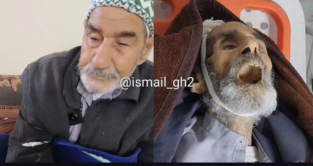 Elderly Palestinian man dies from malnutrition amid occupation