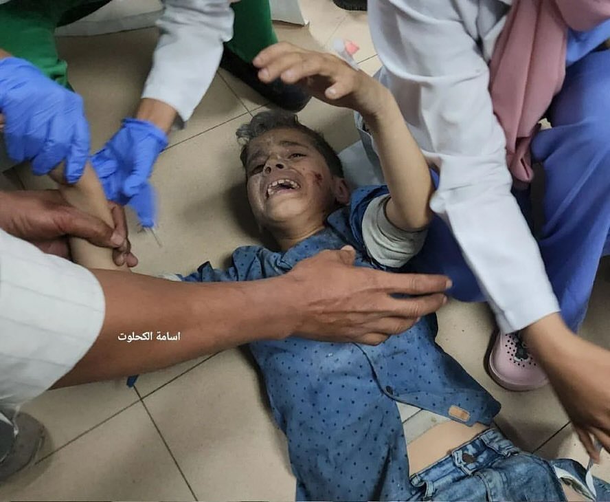 Injured Palestinians arrive at Al Aqsa hospital after Israeli bombardment in central Gaza.