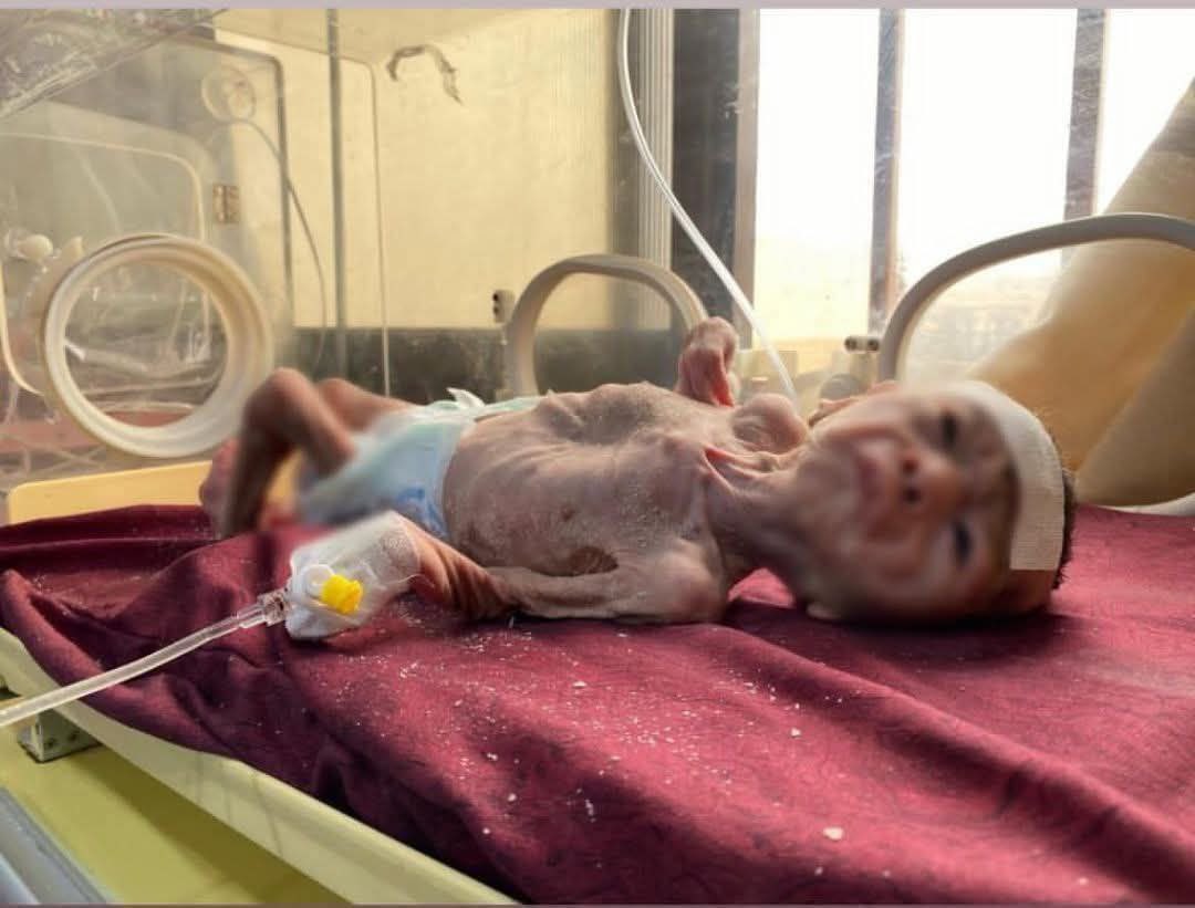 Gazans Face Enforced Starvation Crisis