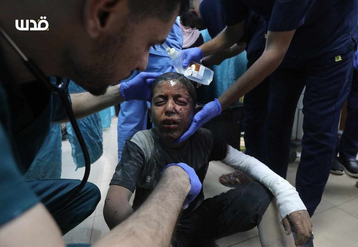 Children and Women Injured in Gaza Raid