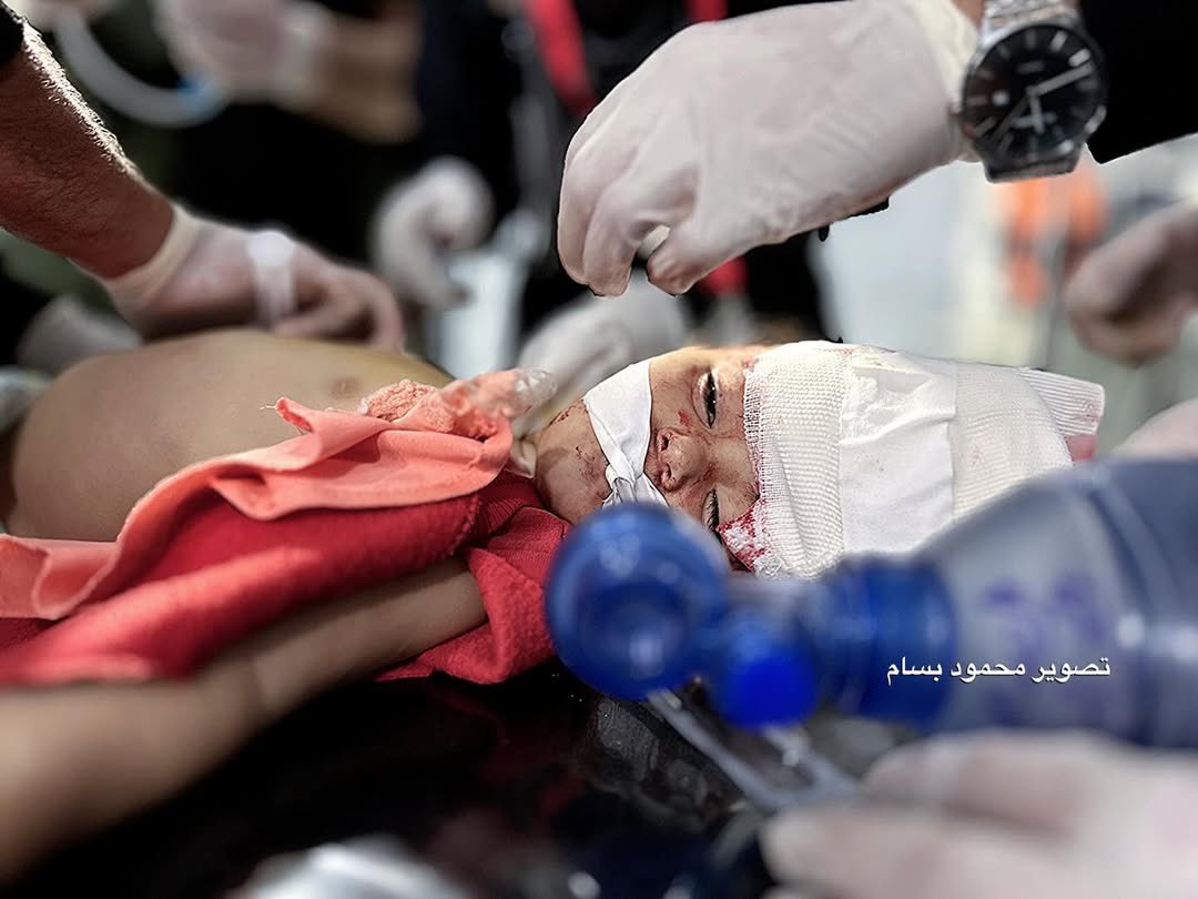 Israeli airstrike injures children and women in Khan Yunis tent
