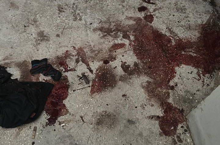 Israeli military operation wounds Palestinians in Nablus