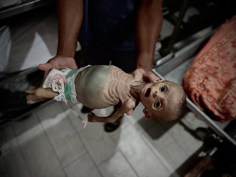 Baby Zainab Abu Hulaib Dies From Hunger During Siege