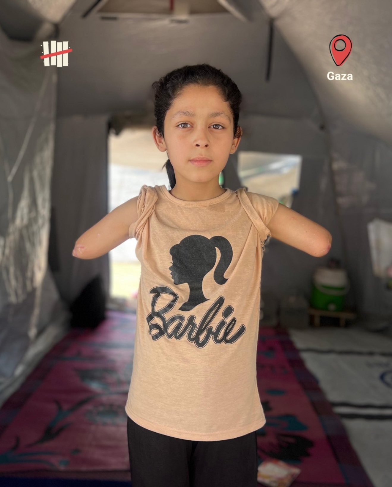 10-Year-Old Sarah Loses Father and Both Arms in Gaza Airstrike