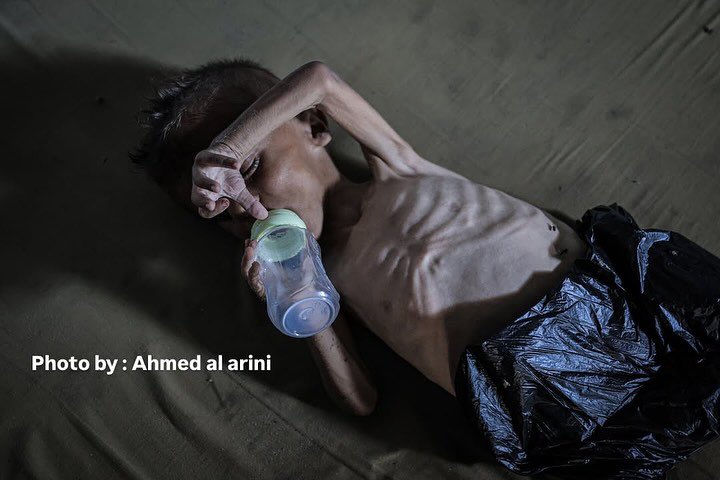 Over 100 Dead from Hunger in Gaza, Mostly Children