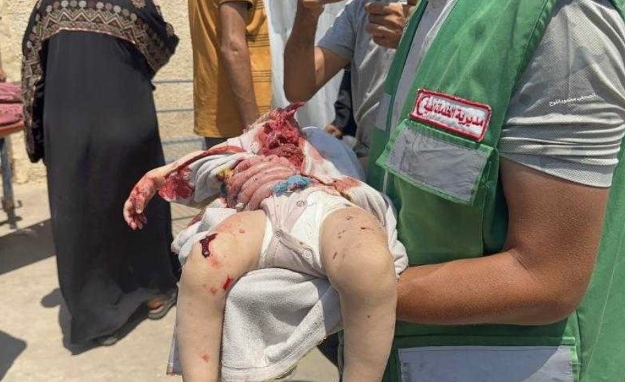 MoH Reports Casualties from Israeli Bombing of Deir al Balah Shelter