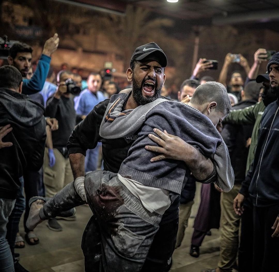 Over 20,000 Palestinians killed, 55,000 injured in Gaza aggression