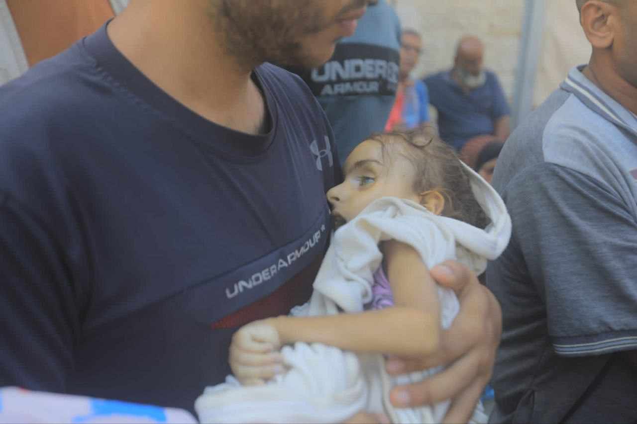 4-year-old Girl Dies from Malnutrition in Gaza Strip