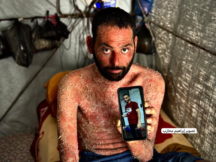 Young Man Needs Urgent Medical Treatment Travel Abroad