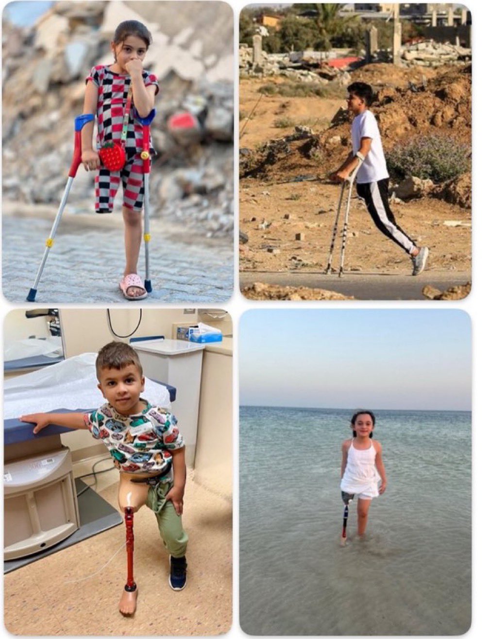 Children in Gaza losing limbs daily in Israeli war