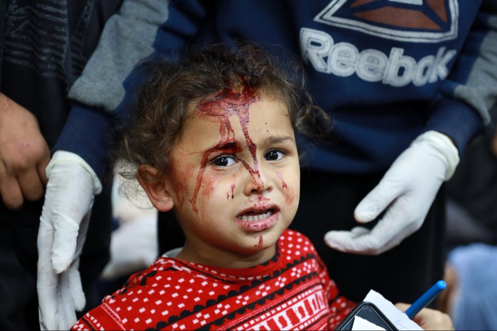 Israeli drone strikes wound 15 displaced persons in Gaza City