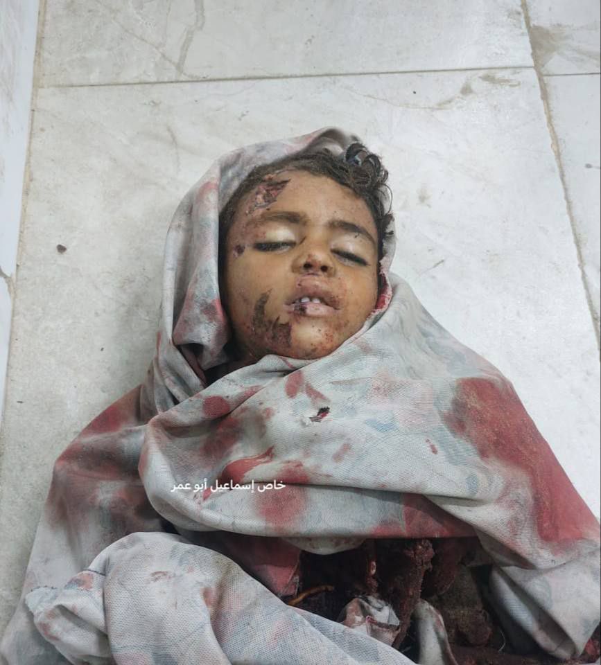 Palestinian Child Killed in Israeli Military Operation Gaza