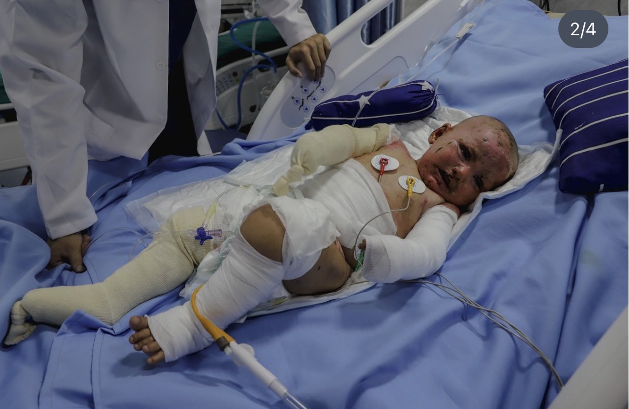 Young Child Sole Survivor After Family Home Targeted Gaza