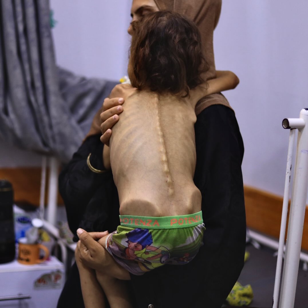 Mother’s testimony on daughter’s long struggle with famine