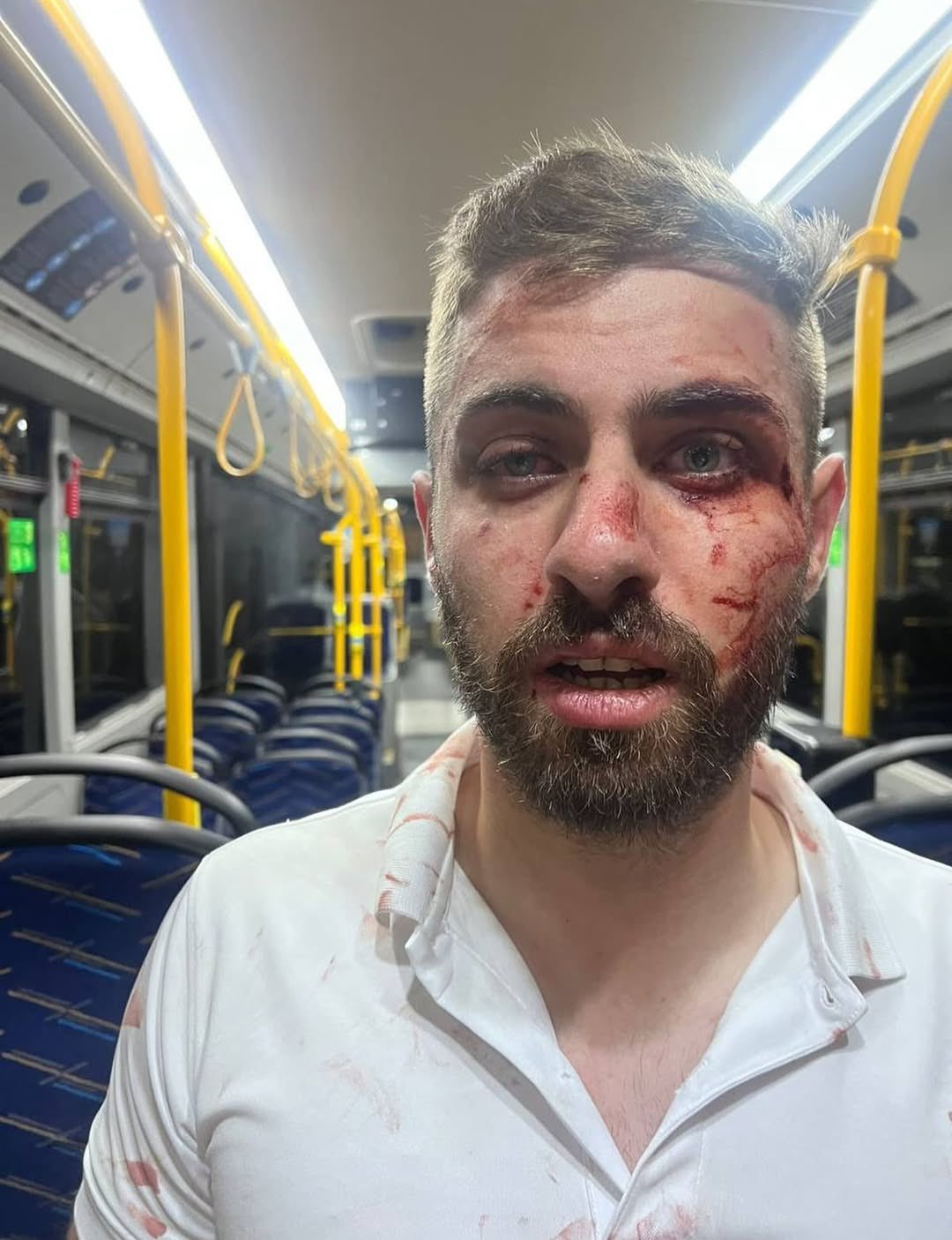 Jerusalemite Ahmad Al-Maghribi assaulted by settlers near Neve Yaakov settlement
