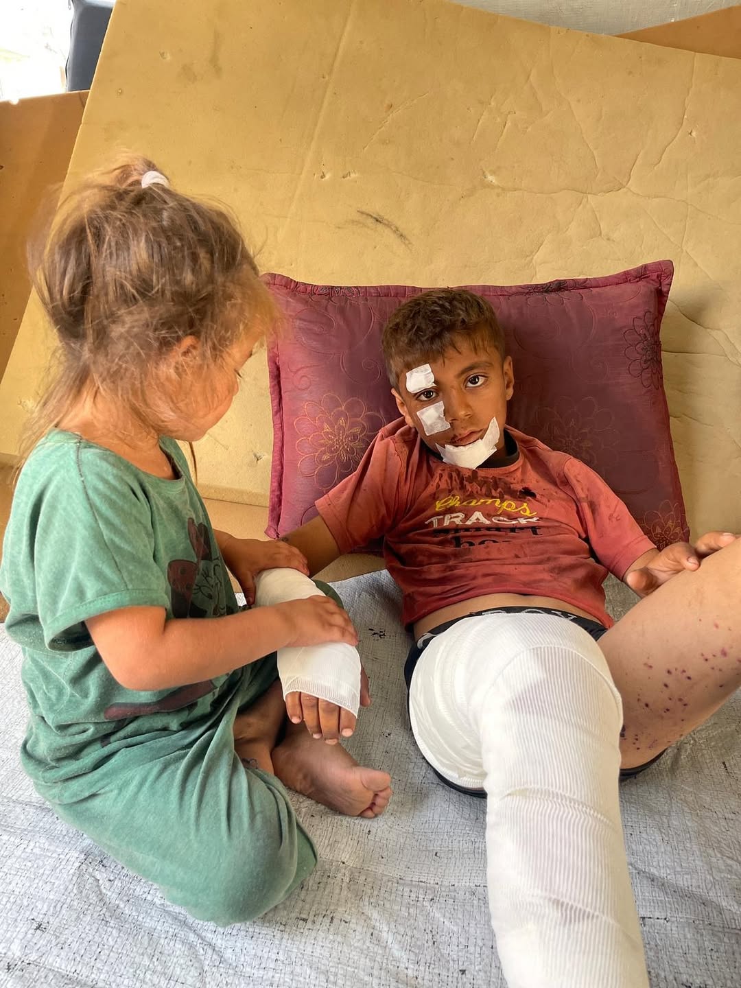 Two children seriously injured by explosive device in Gaza