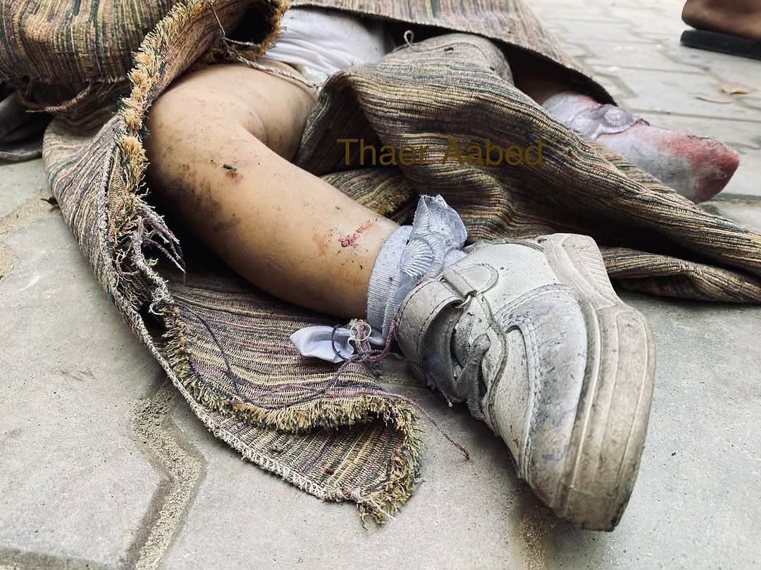 Picture Reveals Ongoing Tragedy of Gaza Children