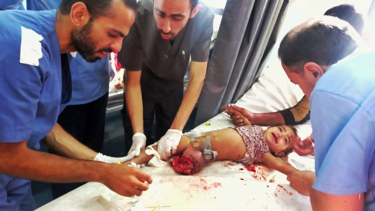 Baby Zeina loses leg in Israeli airstrike on Gaza home