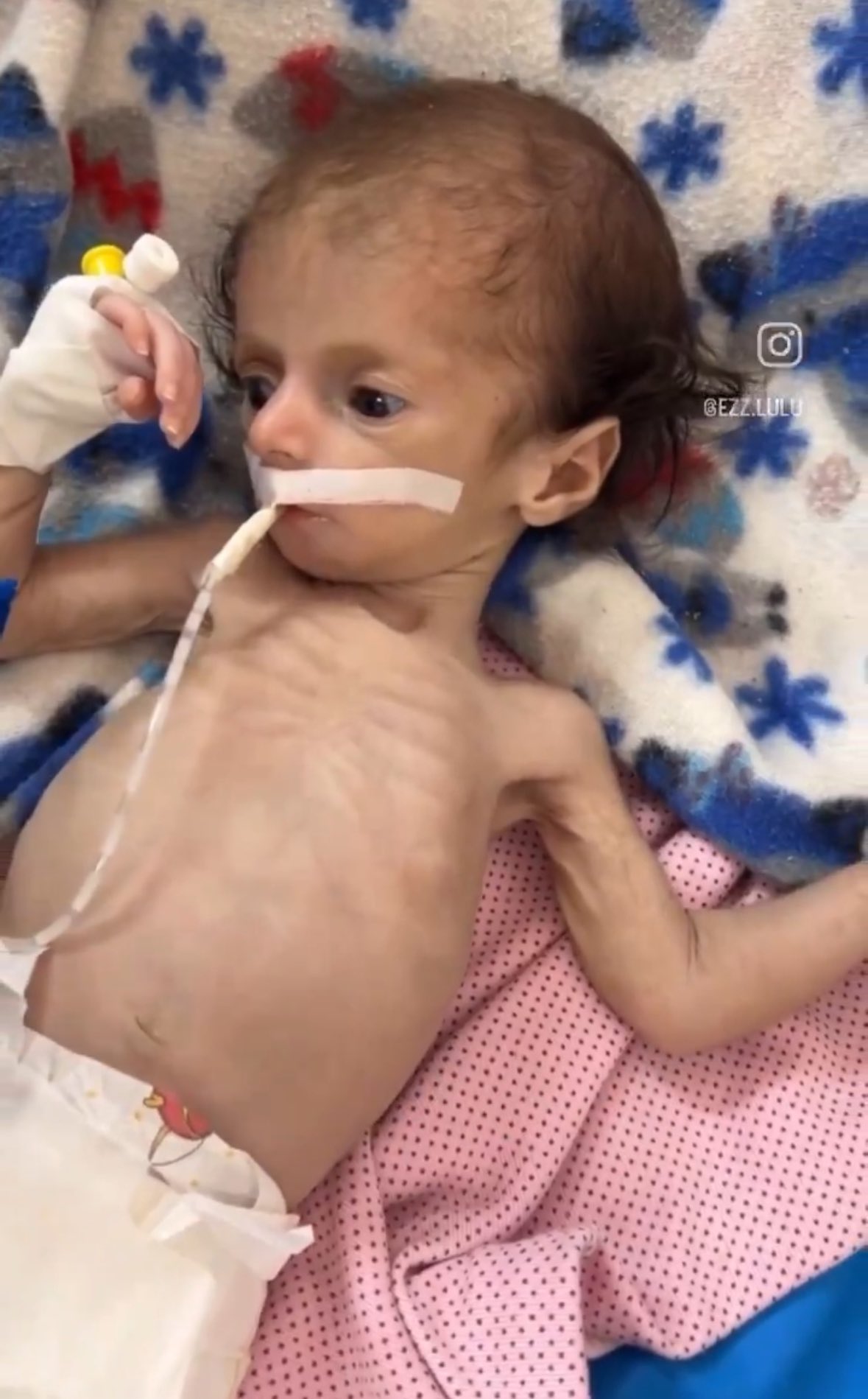 Forced Starvation in Gaza Constitutes Genocide
