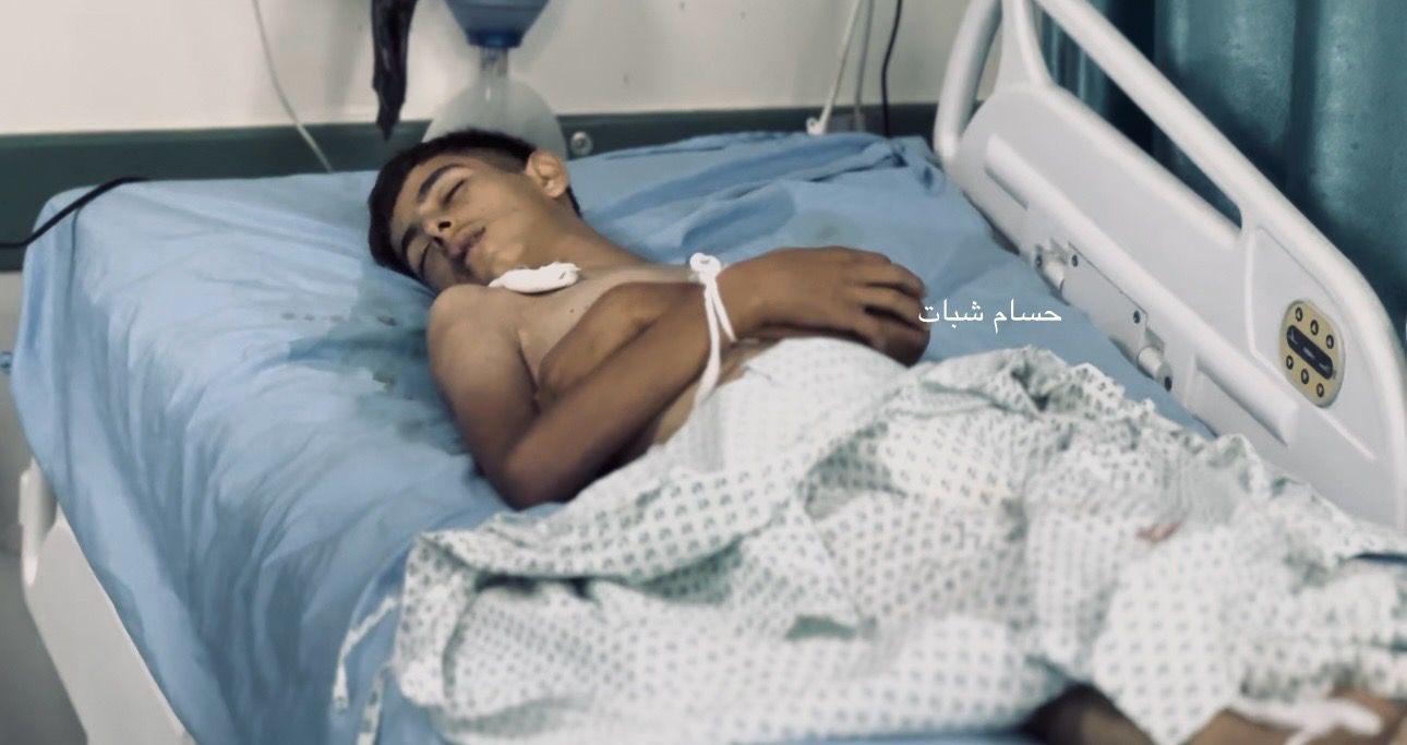 17-year-old Palestinian dies from starvation in Gaza