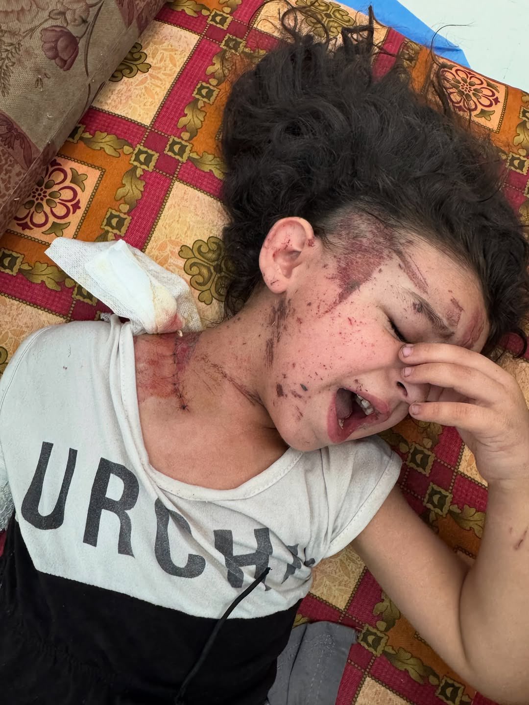 Gaza Survivor Misk Tafesh Suffers Severe Injuries from Airstrike