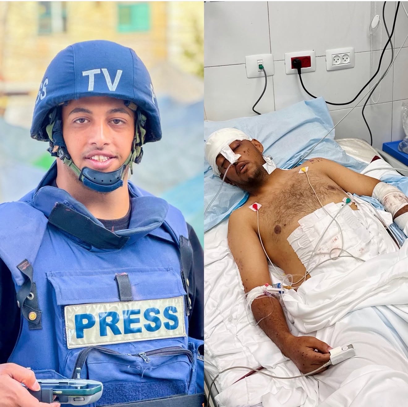 Journalist Shot by Israeli Forces in Gaza Coverage