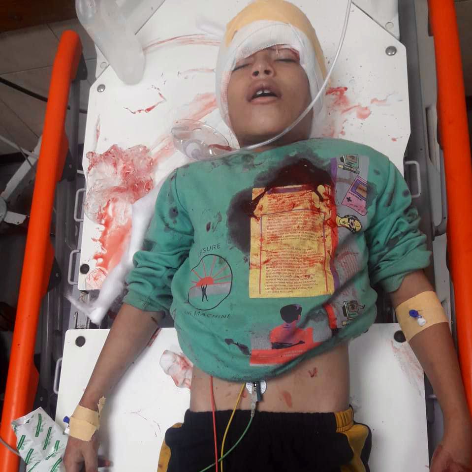 Palestinian Child Dies from Israeli UAV Strike in Gaza