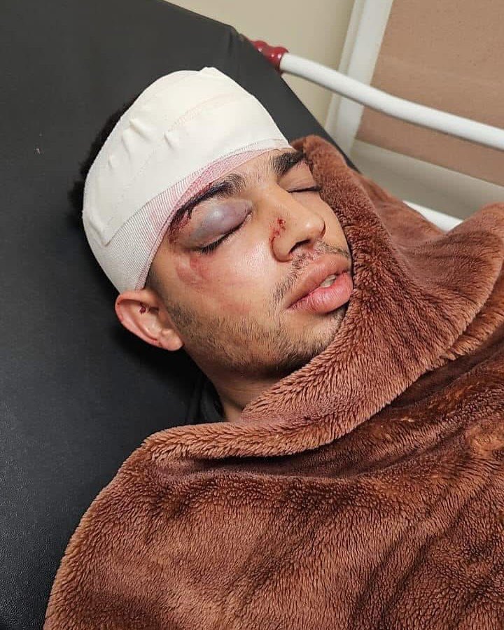 Palestinian Youth Injured in Settler Attack Near Ramallah